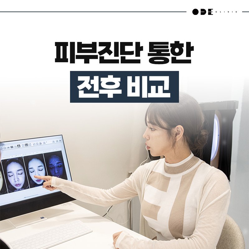 써마지