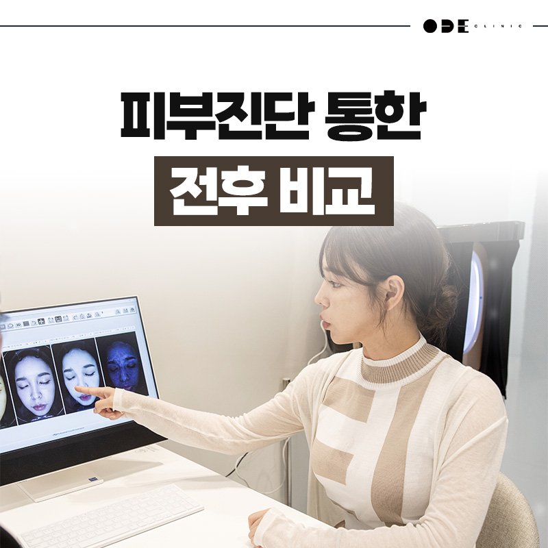 강남 피부과 원장 직접 시술